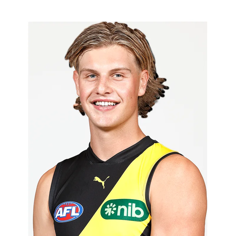 Richmond injury list now up to 15 - Smillie and Gibcus with further setbacks